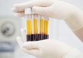Donor Plasma Konvalesen Untuk Selamatkan Nyawa Pasien Covid-19, Ini Syaratnya