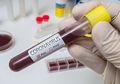 Pasien Ini Miliki Gejala Langka Virus Corona yang Buat Dokter dan Tim Medis Kewalahan! Apa Tandanya?