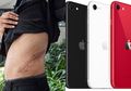 9 Tahun Lalu Nekat Jual Ginjalnya Seharga Rp245 Juta demi iPhone, Kini Remaja Ini Menyesal, Dia Tak Bisa Jalan, Jadi Miskin, hingga Harus Rutin Cuci Darah