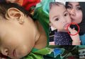Berujung Malapetaka karena Ingin Tampil Gaya di Hari Lebaran, Begini Nasib Seorang Bocah yang Dipakaikan Cincin oleh Orangtuanya