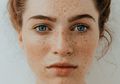 Penyebab Freckles Pada Wajah dan Cara Mengatasinya, Wajib Tahu!
