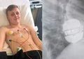 Dokter Larang Remaja Cowok Ini untuk Jatuh Cinta Selamanya, Agar Tetep Bisa Hidup