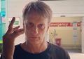 Alami Kecelakaan, Tony Hawk Bagikan Foto Rontgen Tulang Jarinya yang Bergeser
