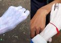 Waspada Krim Pemutih Kulit, Jika Tidak Ingin Putih Seperti Zombie, Ini Buktinya