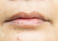 Kelihatannya Sepele, Kebiasaan Mengelupas Kulit Bibir yang Kering Ternyata Bisa Berakibat Fatal!