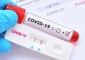 Dokter Spesialis Paru Berikan Opsi Deteksi Kilat Covid-19 Lewat Tes Swab Antigen, Dijamin Lebih Akurat Dibanding Rapid Test