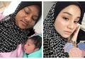Padahal Sebelumnya Putih Bersih, Wajah Wanita Ini Berubah Menjadi Gelap Saat Hamil hingga Membuatnya Terpukul, Rupanya Inilah yang Terjadi