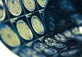 Infeksi Covid-19 Bisa Sebabkan Stroke dan Serang Otak, Tak Lagi Hanya Pneumonia yang Selama Ini Dikhawatirkan