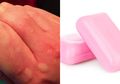 9 Cara Sebagai Obat Biduran Kronis yang Instan, Sabun Tanpa Wangi!