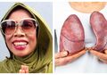 Meninggal Dunia, Komedian Omas Punya Riwayat Penyakit Komplikasi, 6 Cara Ini Dapat Menjaga Paru-paru Anda Tetap Sehat
