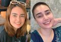 Unggah Foto dengan Penampilan Rambut yang Nyaris Botak, Feby Febiola Akui Tengah Berjuang Lawan Penyakit Mematikan
