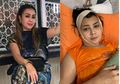Niat Percantik Diri dengan Filler, Bibir Aktris Ini Justru Bengkak Hingga Dagunya Keras Membatu Mengeluarkan Nanah, Diduga Alami Malpraktik: Jadi Apa yang Disuntikin?