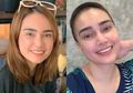 Dikira Biasa Saja, 2 Minggu Perut Terasa Kembung Hingga Tak Doyan Makan, Artis Cantik Ini Tak Menyangka di Tubuhnya Ada Tumor Ganas Bersarang, Begini Kisahnya