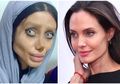 Dulu Sangat Viral Wajahnya Hancur Total Gara-gara Oplas Supaya Mirip Angelina Jolie, Wanita Ini Kini Nasibnya Sungguh Mengenaskan, Meringkuk di Penjara Sambil Menderita Covid-19