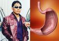 Erwin Prasetya Meninggal Karena Pendarahan Lambung, Ternyata Konsumsi Jenis Makanan Sejuta Umat Ini Bisa Merusak Lambung Kita Loh, Hati-hati!