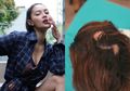Ngeri Banget! Artis Seksi Ini Idap Gangguan Mental & Autoimun Hingga Alami Kebotakan