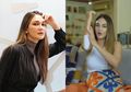 Luna Maya Alami Kecelakaan, Luka di Pelipis hingga Terima Lima Jahitan di Tangan
