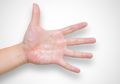 Keringkan Telapak Tangan dan Telapak Kaki yang Terus Berkeringat dengan Menggunakan Baking Soda, Cukup 20 Menit Saja!