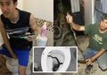 Naas Parah, Cowok Ini Kepatok Ular Dari Dalam Toilet, Tiba-Tiba Kemaluan Terasa Nyeri