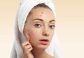 Apa Itu Fungal Acne? Ini Penyebab dan Cara Mencegahnya Menurut Ahli