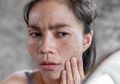 Pemilik Kulit Gelap, Ini Cara Ampuh Menghilangkan Flek Hitam di Wajah