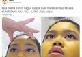 Susah Dibersihkan, Wajah Gadis Ini Jadi Berwarna Kuning Usai Pakai Masker Kunyit, Sampai Malu Keluar Kosan: Nggak Hilang 2 Hari!