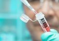 Saat Virus Corona Dianggap Pejabat Dunia Sebagai 'Peluru' Baru dalam Perang Dunia III, Masih Adakah Harapan Vaksin yang Sembuhkan Warga Dunia?