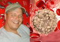 Pria ini Bongkar Rahasianya Sembuh dari Leukemia Tanpa Kemoterapi, Cuma Rutin Makan Dua Bahan Ini Mentah-mentah!