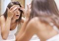 Banyak Jerawat Tanda Perempuan Sedang Dalam Masa Subur? Yang Benar Terlalu Banyak Makan Lemak