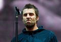 Begini Kondisi Liam Gallagher Usai Jatuh Dari Helikopter, Foto Bekas Lukanya Bakal Jadi Sampul Album