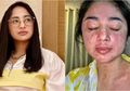 Tak Hanya Sekali, Ternyata Dewi Perssik Dua Kali Terkonfirmasi Covid-19 dalam Sebulan, Ini yang Pedangdut Tersebut Alami