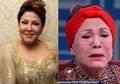 Duh! Tergiur Wajah Cantik, Mpok Atiek Malah Menyesal Seumur Hidup Nekat Lakukan Suntik Silikon di Salon: Muka Kedodoran Siapa Mau Lihat?
