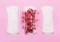 Malas Ganti Pembalut dan Lalai Jaga Kebersihan Miss V saat Menstruasi Bisa Bikin Infeksi Bakteri! Begini Penjelasannya