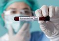 Setelah Inggris, Jerman dan China Juga Temukan Varian Virus Corona Baru yang Berbeda