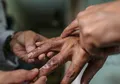 Jangan Sampai Kecolongan, Tren Penderita Penyakit Kusta Terus Meningkat, Termasuk Anak-anak, Kenali Gejala Awalnya!