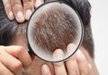 Banyak Uban Jadi Tak Percaya Diri? Coba Cara Ini Jadi Obat Alami Atasi Rambut Putih