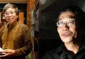 Jalaludin Rahmat Meninggal Karena Covid-19 Komorbid Diabetes, Apa Itu?