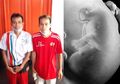 Sampai Disebut Desa Orang Kembar, Inilah Desa Jonggrangan yang Punya Puluhan Pasang Orang Kembar Identik, Apa Pemicunya?