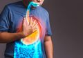 4 Kiat Ampuh Supaya Pernyakit Asam Lambung Tak Ganggu Libur Lebaran