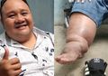 Ngeri Banget! Pesinetron Ini Kakinya Bengkak Misterius Selama Enam Tahun dan Ngaku Disantet Artis Lain: Saya Susah Ngomong