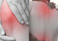 Pantas Mudah Didapat! Ternyata Bumbu Dapur Ini Bisa Jadi Obat Alami Rematik