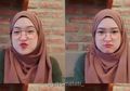 Apes Punya Wajah Mirip Nissa Sabyan, Gadis Cantik Ini Hanya Bisa Pasrah saat Dihujat Netizen: Kita gak Pernah Minta Begini juga, kan