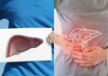Ini Dia Obat Liver Alami Paling Ampuh, Pasti Mudah Didapat Kok!