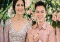 Belajar dari Baim Wong Derita Penyakit Manula di Usia Muda, Yuk Hindari 3 Kebiasaan Buruk Ini Supaya Tak Terjangkit Katarak