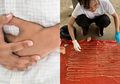 Berawal dari Sakit Perut, Dokter Kaget Setelah Bedah Perut Pasien Ini, Temukan Makhluk yang Dilihatnya Sekali Selama 50 Tahun Memiliki Panjang 18 Meter