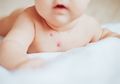 Tak Seribet Dibayangkan! Ternyata Begini Pengobatan Roseola Infantum Pada Anak, Mulai Berikan Obat Penurun Panas hingga Makan Bergizi
