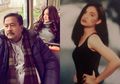 Dulu Ngetop Berkat Main di Film Si Doel, Artis Cantik Ini Bernasib Miris! Derita Penyakit Langka hingga Jari-Jari Bengkok