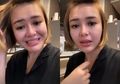 Sempat Heboh Dikira Filler, Amanda Manopo Ternyata Lakukan Suntik Vitamin C di Bibir, Apa Manfaatnya?