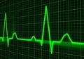 Mengapa Anda Harus Melakukan Pemeriksaan Jantung setelah Sembuh dari Covid-19?