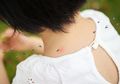 Penyakit Infeksi Malaria, Nyamuk Malaria Suka Aroma Tubuh Manusia, Waspada!